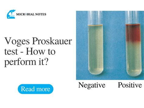 voges proskauer test how many drops do i put in|voges proskauer protocol.